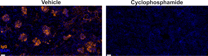 Illustrative images of IgG in kidney cortex